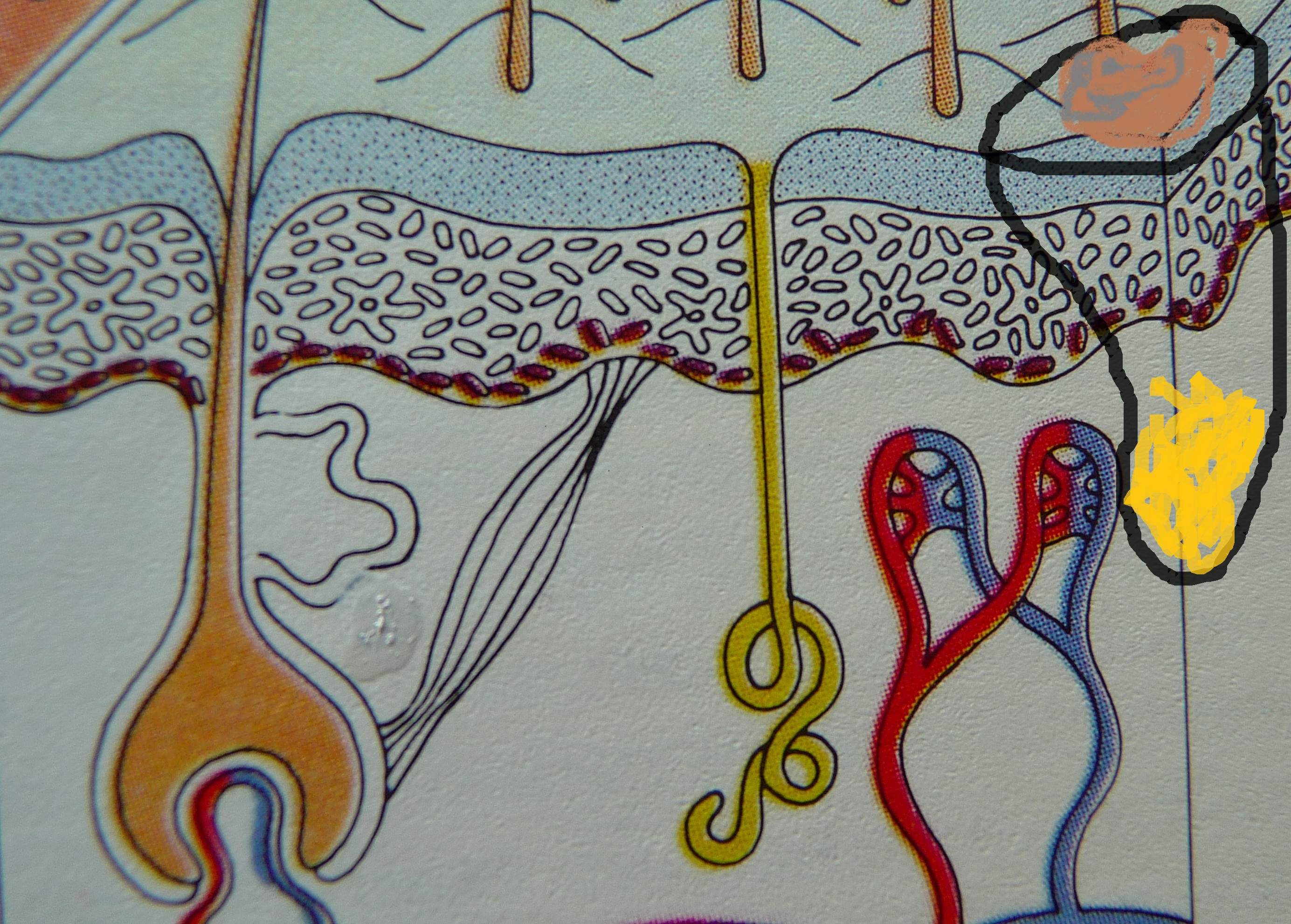 Punch biopsy Archives GROSSING TECHNOLOGY in SURGICAL PATHOLOGY