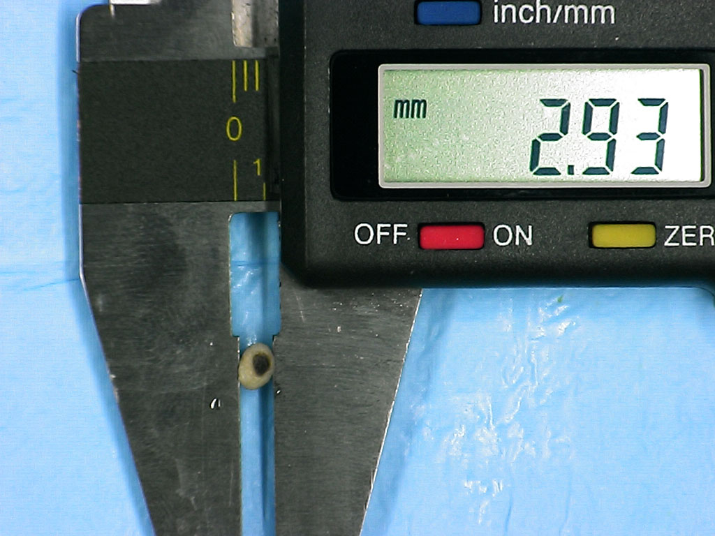 Punch biopsy Archives GROSSING TECHNOLOGY in SURGICAL PATHOLOGY