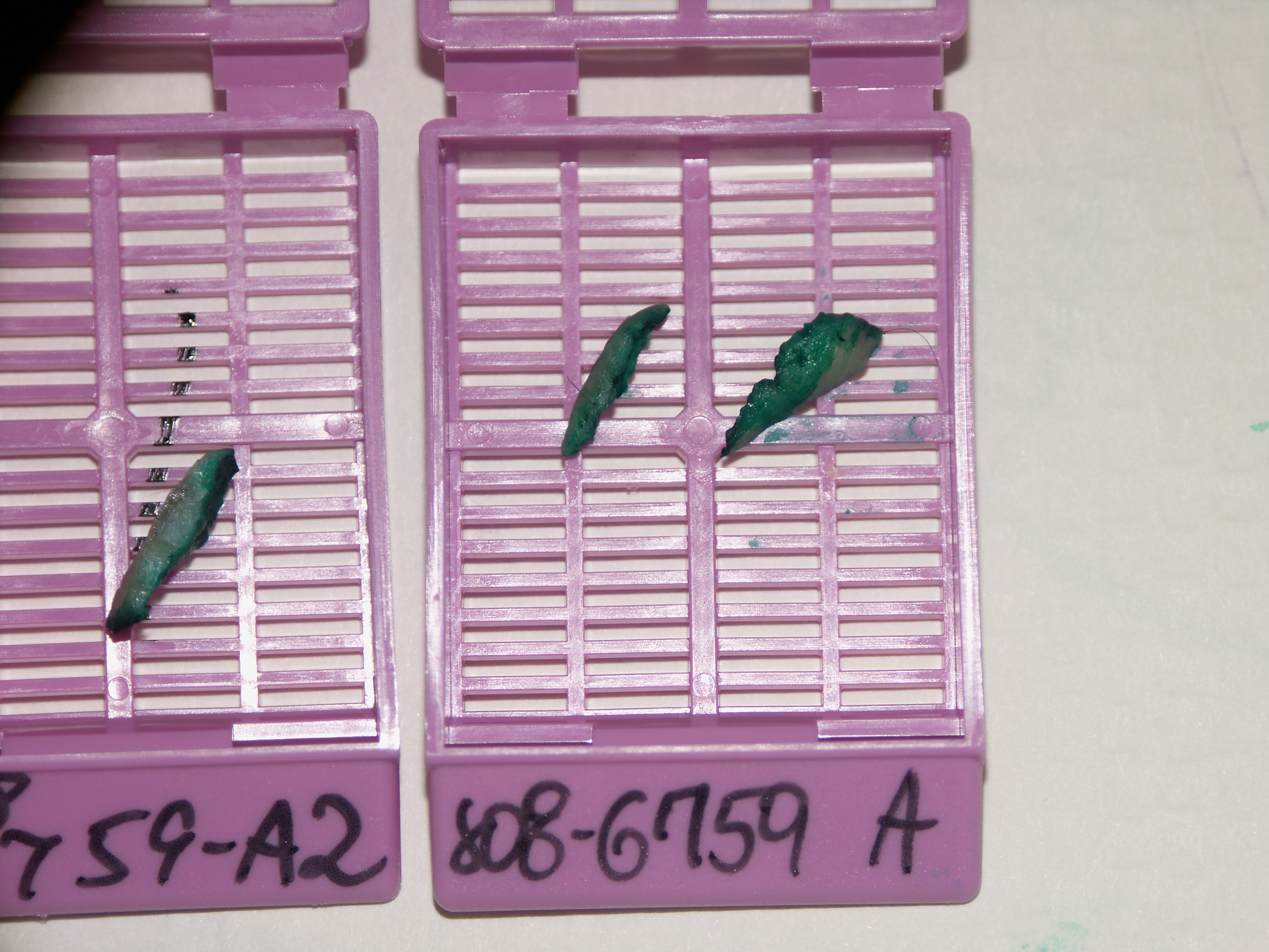 Skin Punch Biopsy GROSSING TECHNOLOGY in SURGICAL PATHOLOGY
