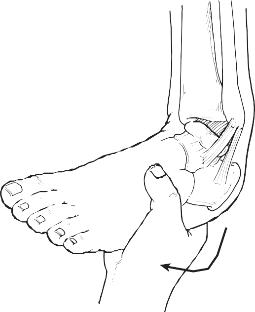 What Is Chronic Ankle Instability? Garden state foot ankle group Dr