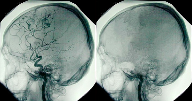 Brain Death Means No Recovery, Learn to Let Go Guardian Liberty Voice