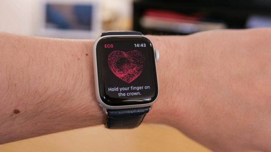 Есть ли ЭКГ на Эппл Вотч SE? GuideApple