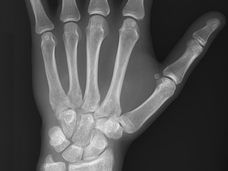 XRay Repair Help Learn How to Fix It Yourself.