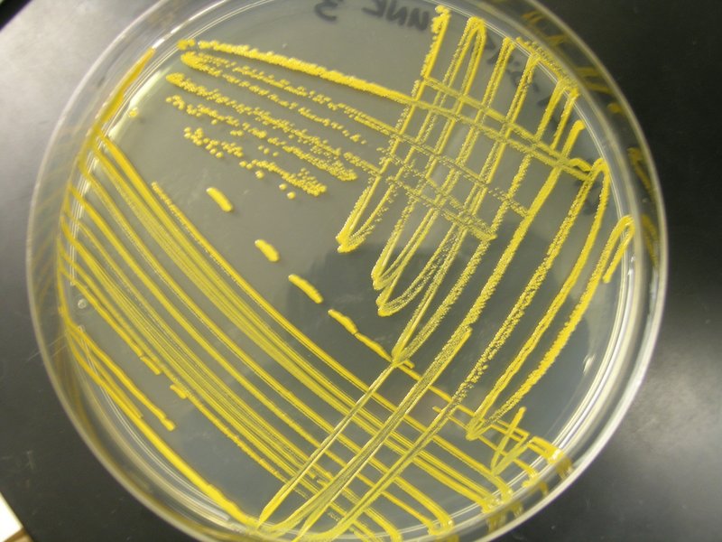 Microbiological Streaking Repair Help Learn How to Fix It Yourself.
