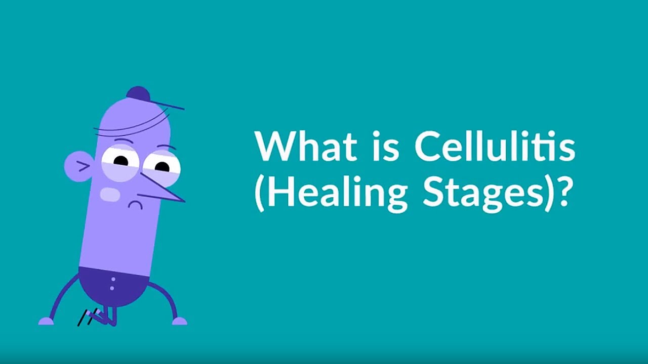 What are the different cellulitis healing stages? Gymbuddy Now