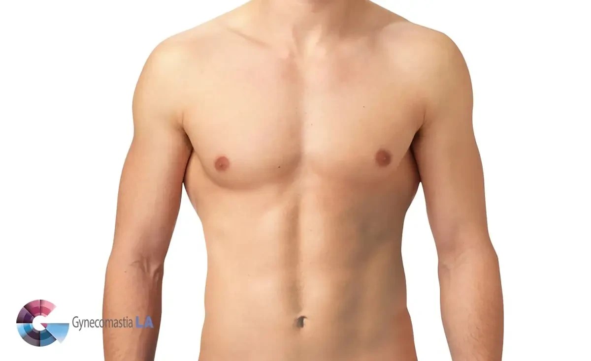 Different male chest types LA Surgery Center