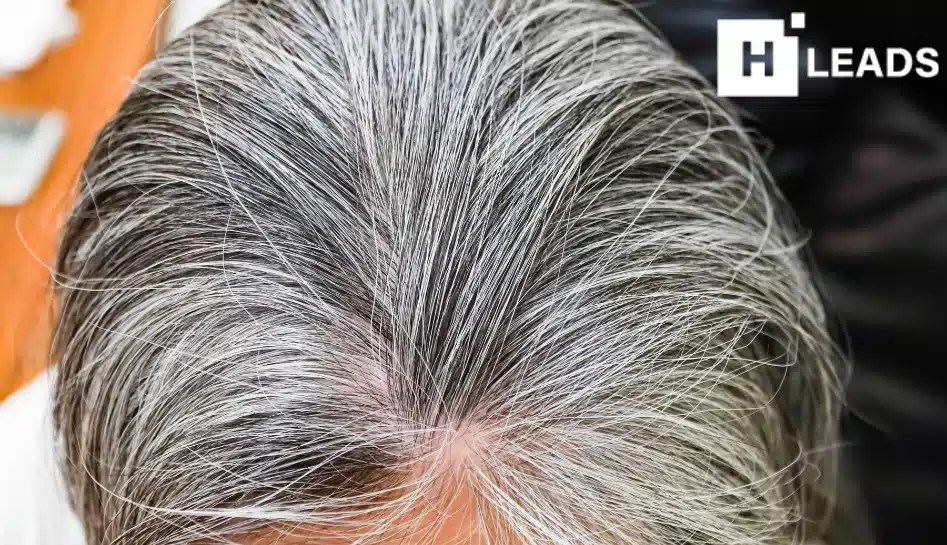 Details more than 78 stop grey hair in.eteachers