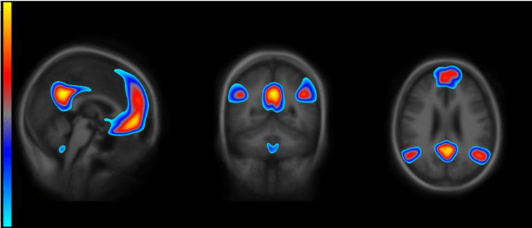 Resources Harvard Aging Brain Study