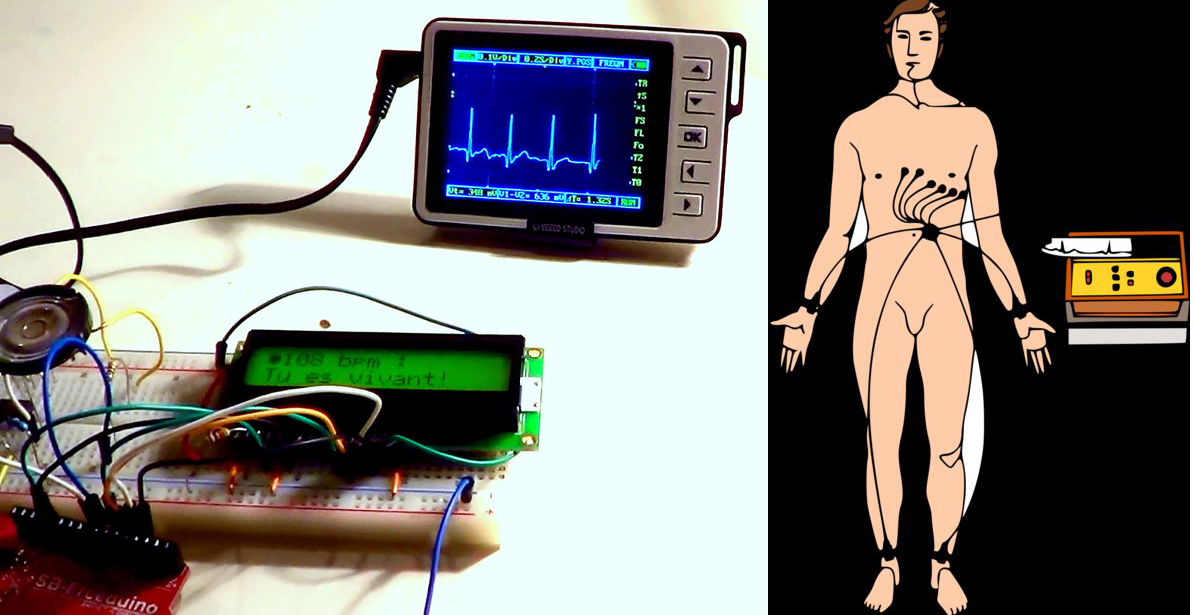 Arduino Powered ECG Informs Users Of Their Death Hackaday