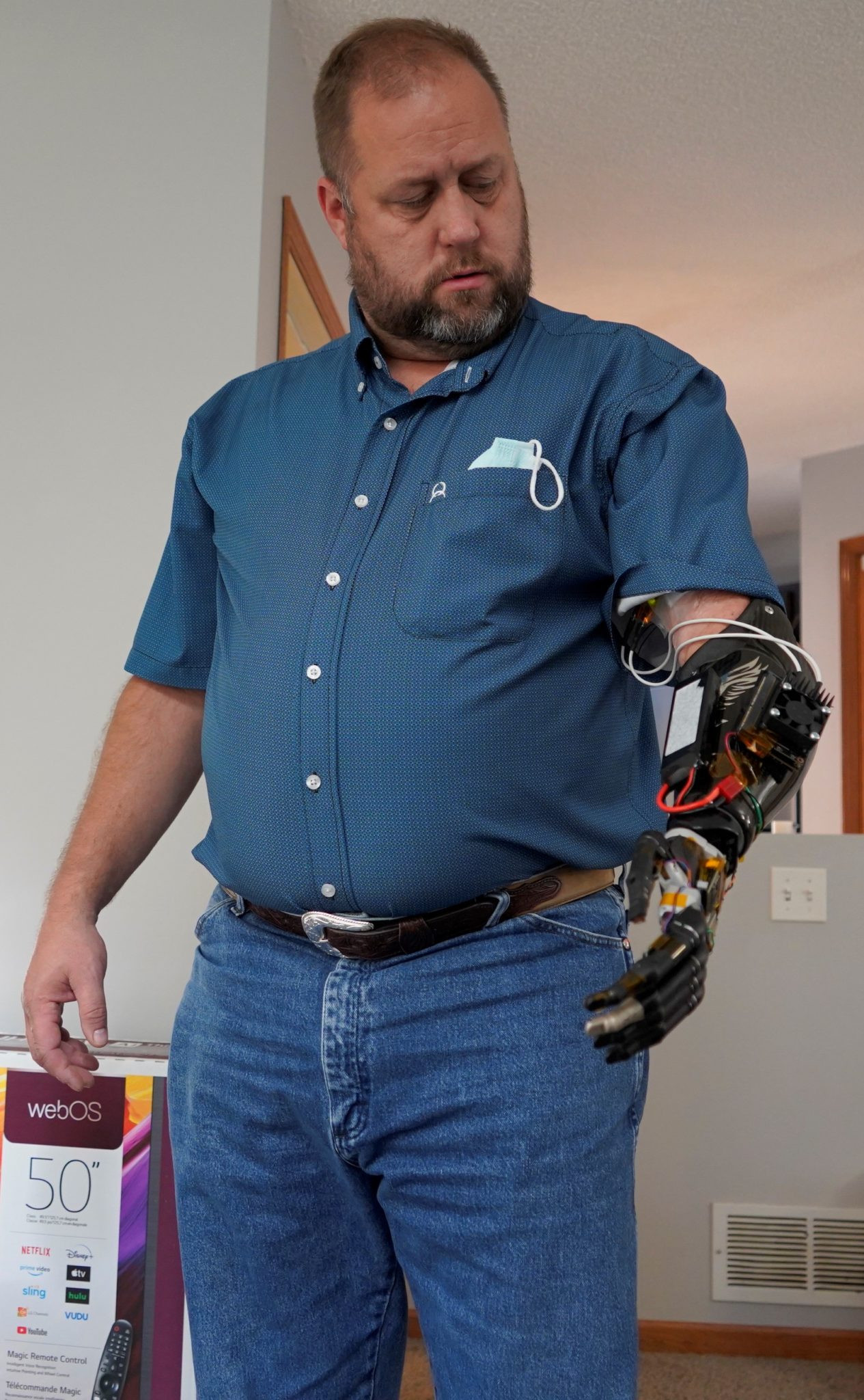 Prosthetic Arm Hackaday