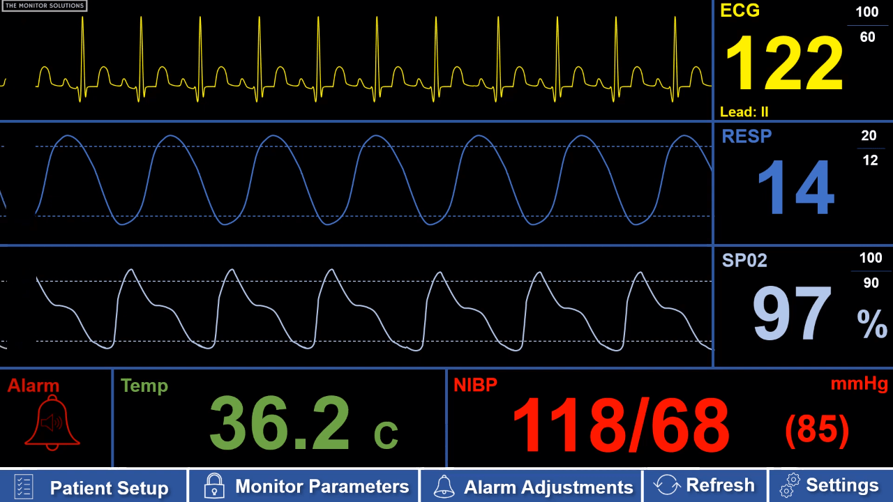 What Can We Do With These Patient Monitor Videos? Hackaday