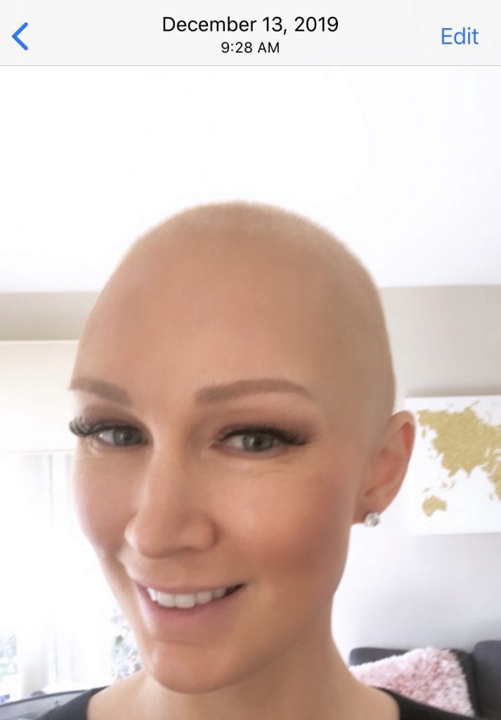 How Soon Does Hair Grow After Chemo