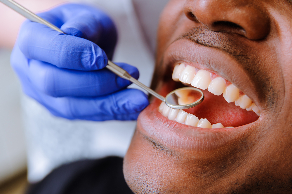 Why Is Regular Teeth Cleaning So Important? Rockville Dentist