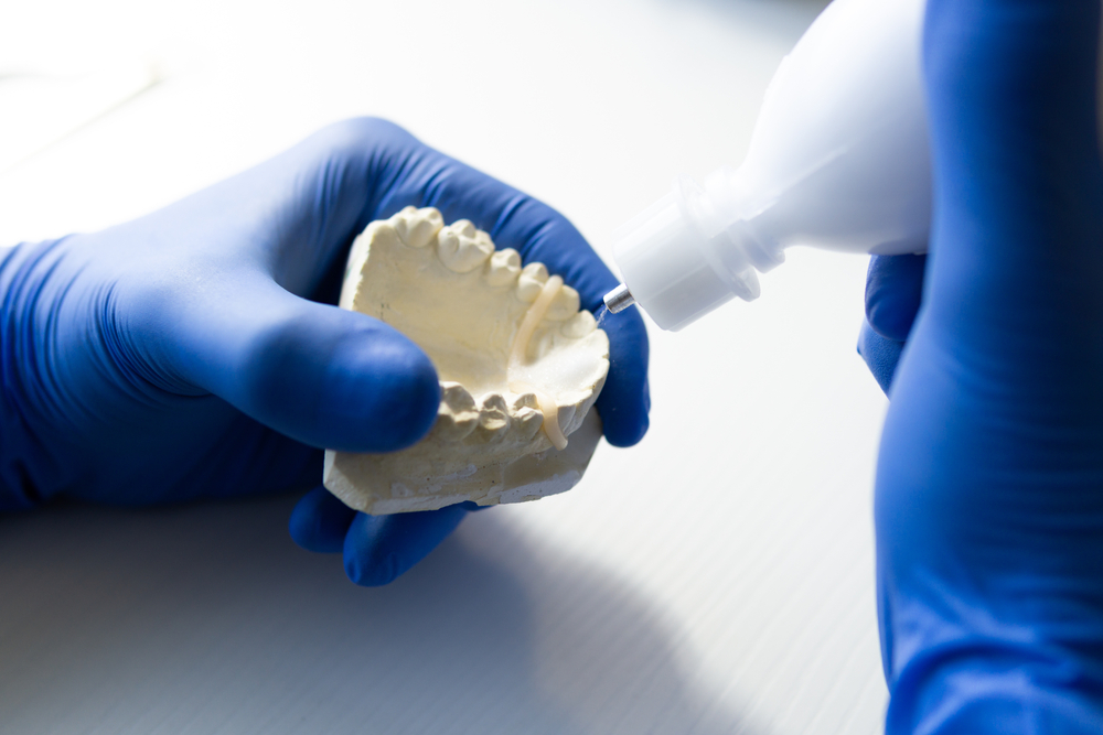 Is a Dental Bridge Permanent? Rockville Dentist