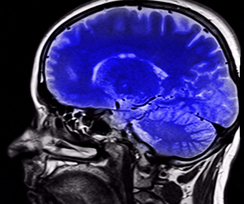 Neuroscience reveals the shocking impact narcissistic