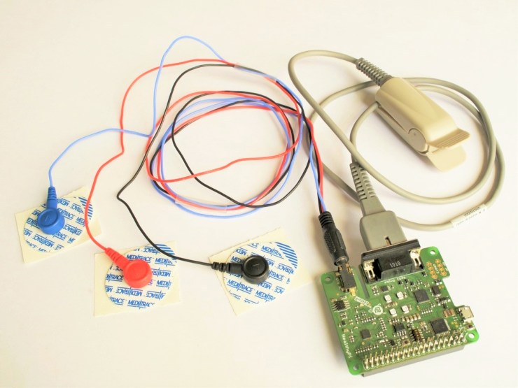 Build Your Own Patient Monitor With A Raspberry Pi Hackster.io