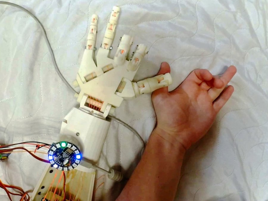 Robotic Hand Control Using EMG Hackster.io