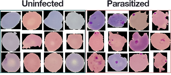 Malaria Detection using Open Microscope and Deep learning Hackster.io