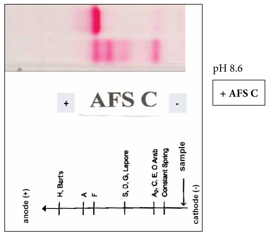 Haemoglobin electrophoresis and HPLC HAEMA