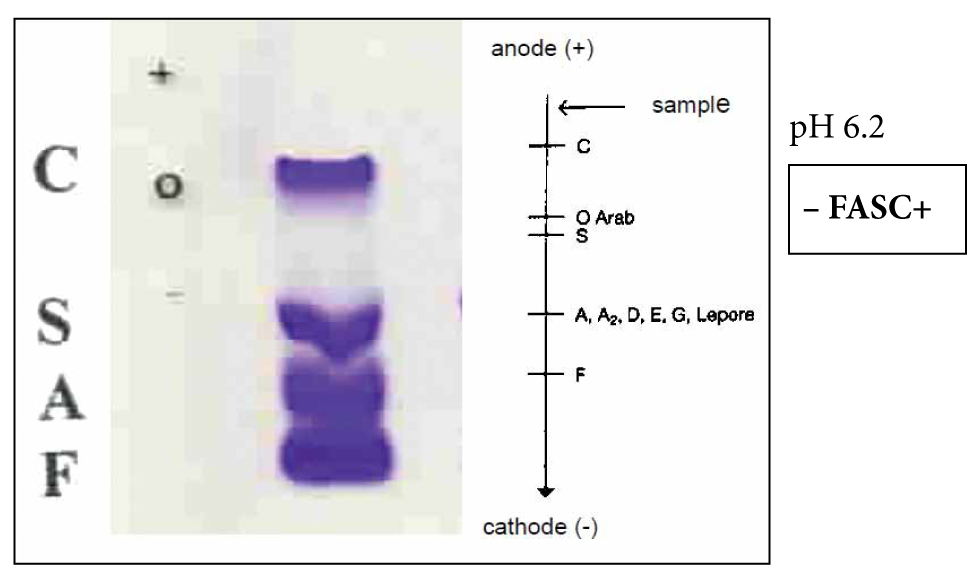 Haemoglobin electrophoresis and HPLC HAEMA