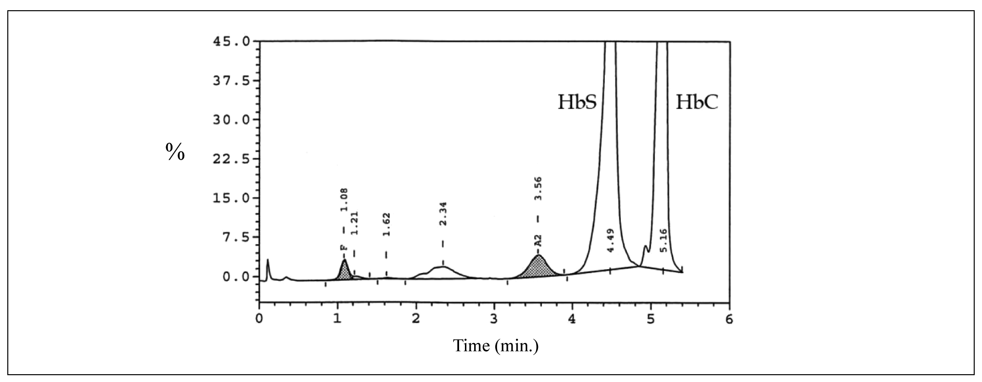Haemoglobin electrophoresis and HPLC HAEMA