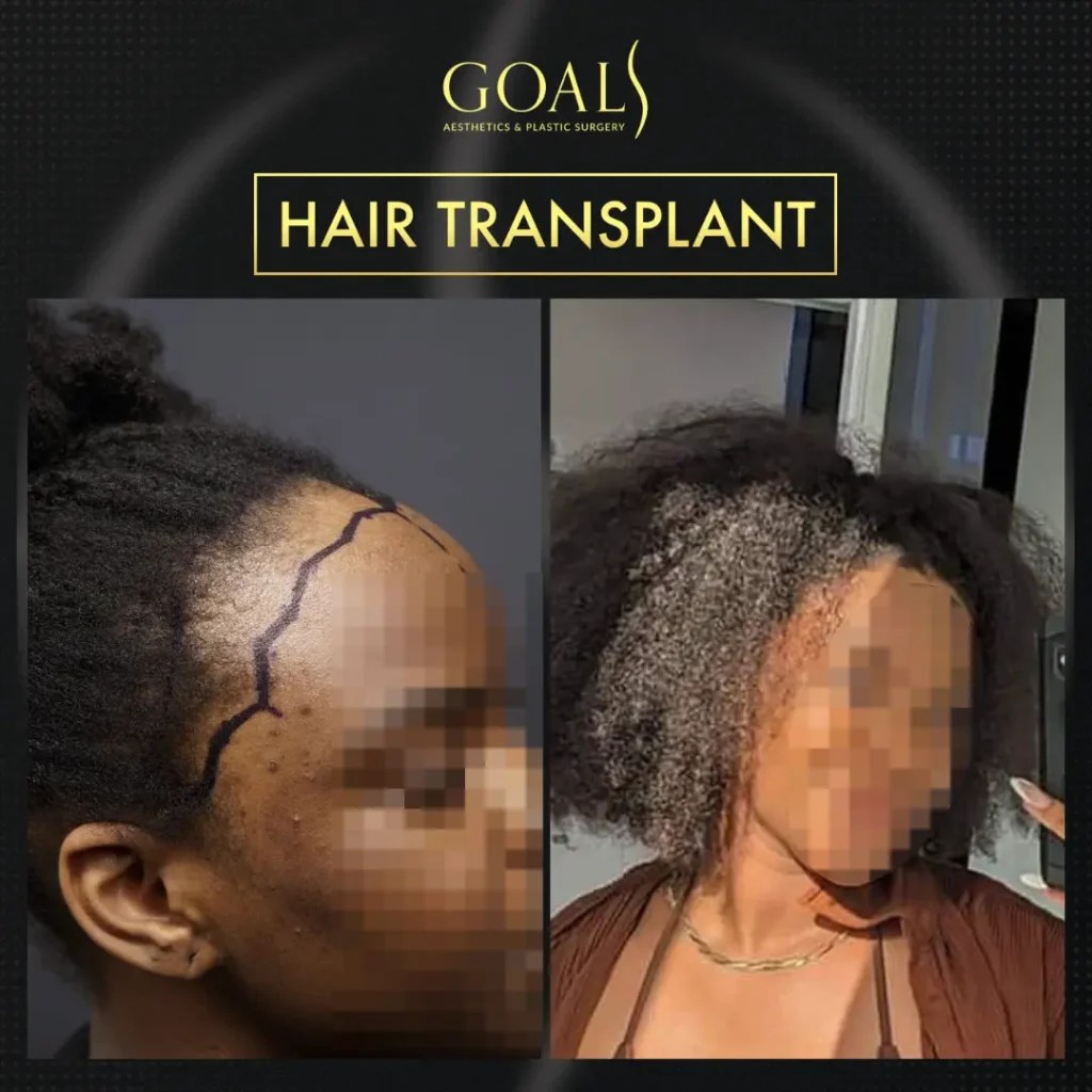 Goals Plastic Surgery® Transform with Goals Plastic Surgery® 11