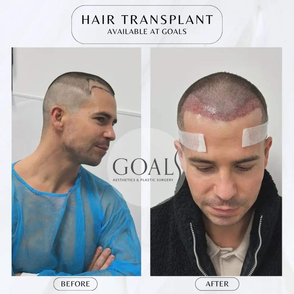 Goals Plastic Surgery® Transform with Goals Plastic Surgery® 11