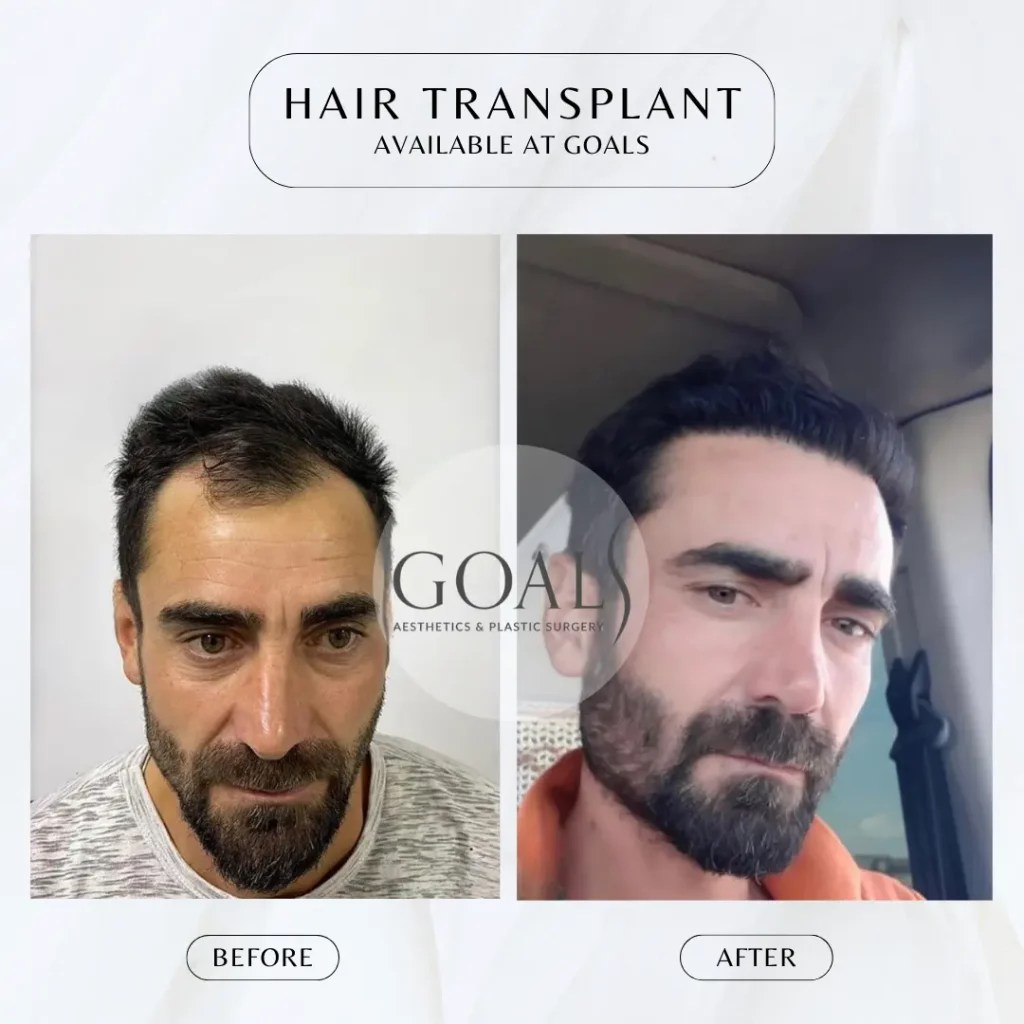 Goals Plastic Surgery® Transform with Goals Plastic Surgery® 11 Locations, Flexible