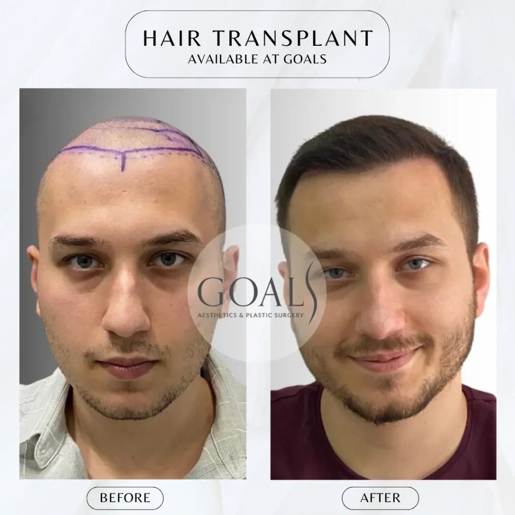 Goals Plastic Surgery® Transform with Goals Plastic Surgery® 11 Locations, Flexible