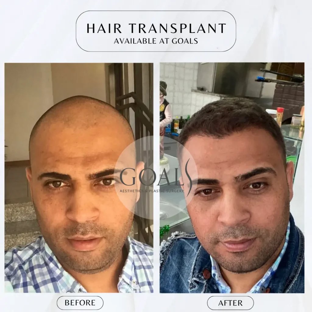 Goals Plastic Surgery® Transform with Goals Plastic Surgery® 11 Locations, Flexible