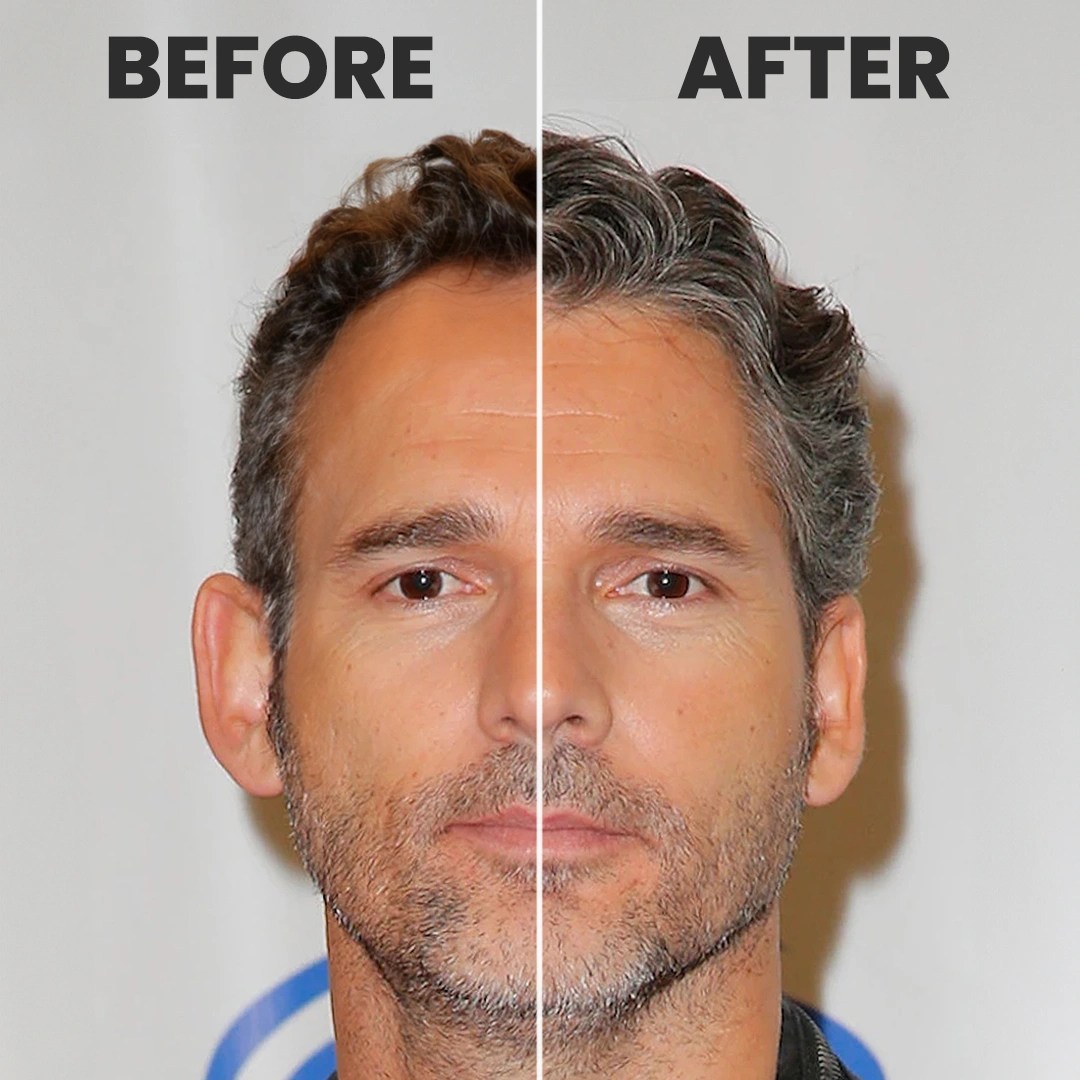 Eric Bana’s Bold Transformation Hair Transplant Simulation and New Look