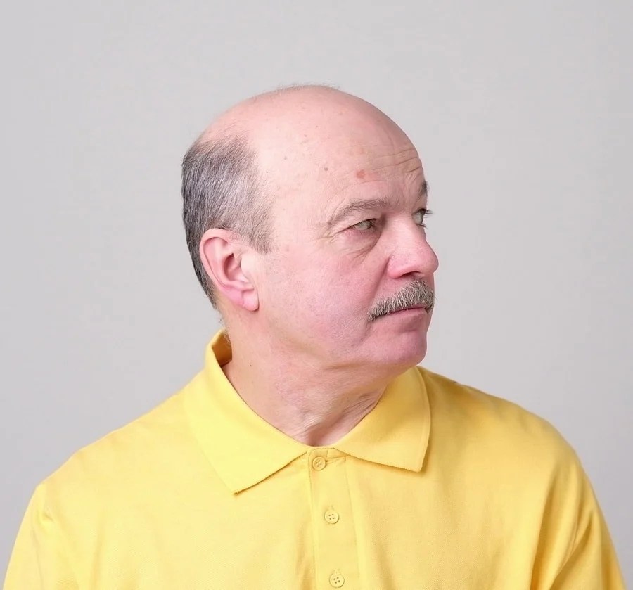 Bald on Top, Hair on Sides The Complete Styling Guide