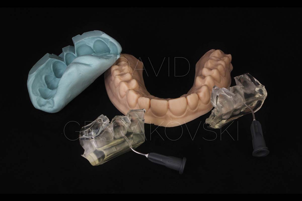 Course Flowable Injection Technique Geštakovski Dr. Jan Hajtó, München