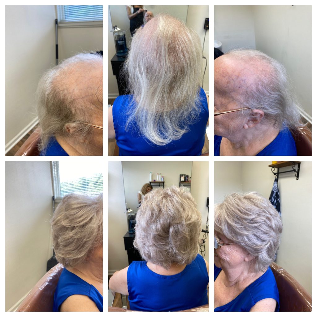 Hair Replacement Gallery Halo Salon & Hair Restoration