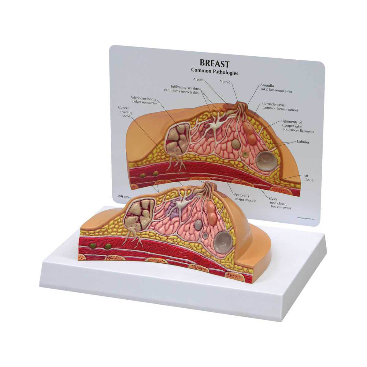 3B Scientific Breast CrossSection Model 3B Smart Anatomy