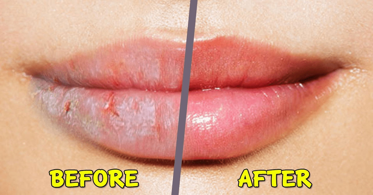 Lips Care Tips For Winter In Urdu Beauty Tips In Urdu