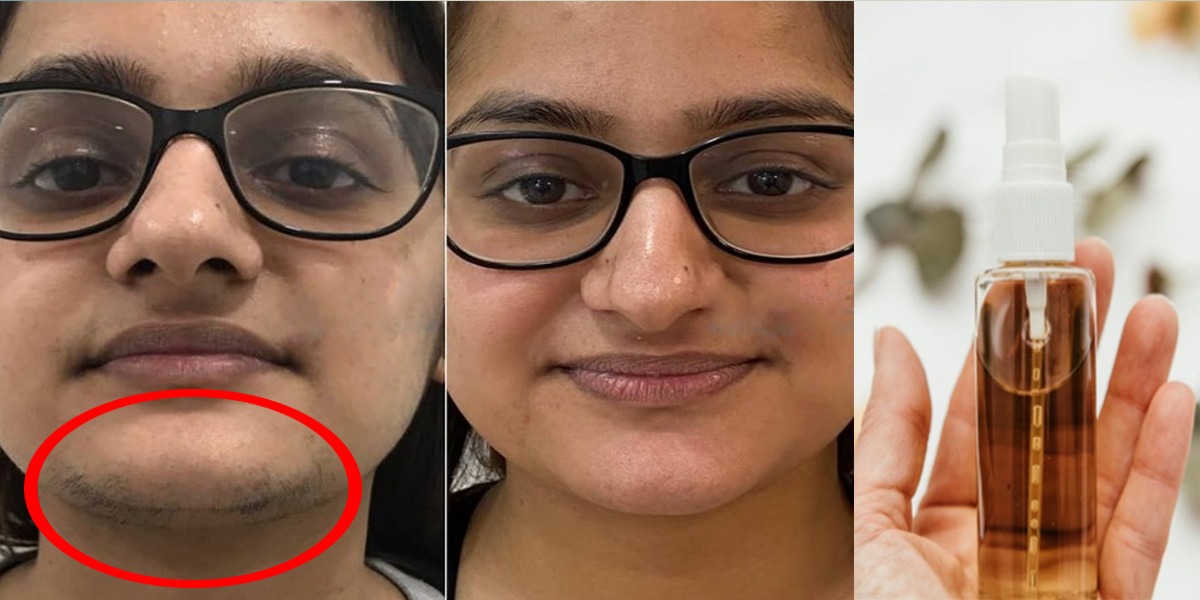 Facial Hair Removal Serum In Urdu Beauty Tips In Urdu