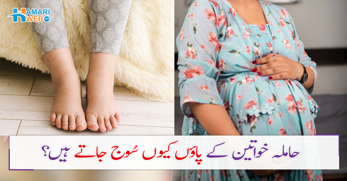 Why Foot Swell In Pregnancy In Urdu Women Health And Fitness