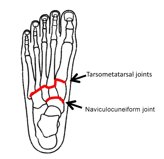 Tarsometatarsal Joint
