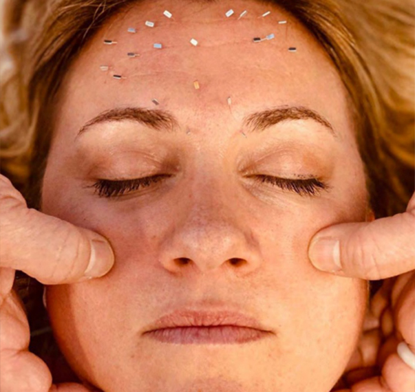 Acupuncture New York, Facial Acupuncture NYC and Cosmetic Acupuncture