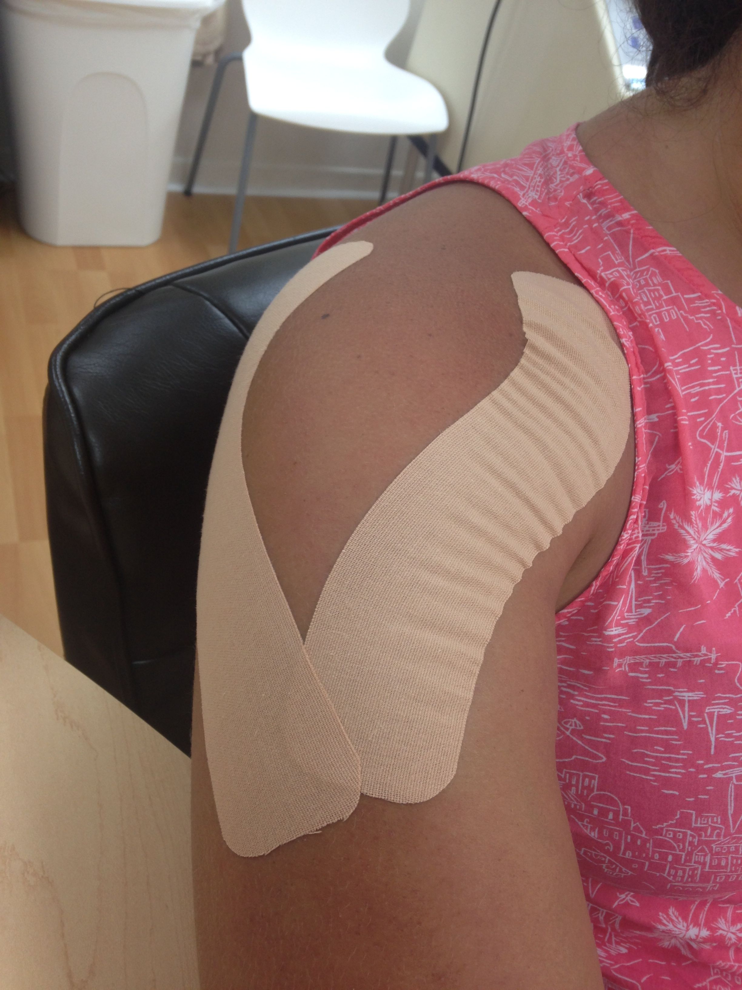 Shoulder pain after breast cancer surgery. Hands on Therapy