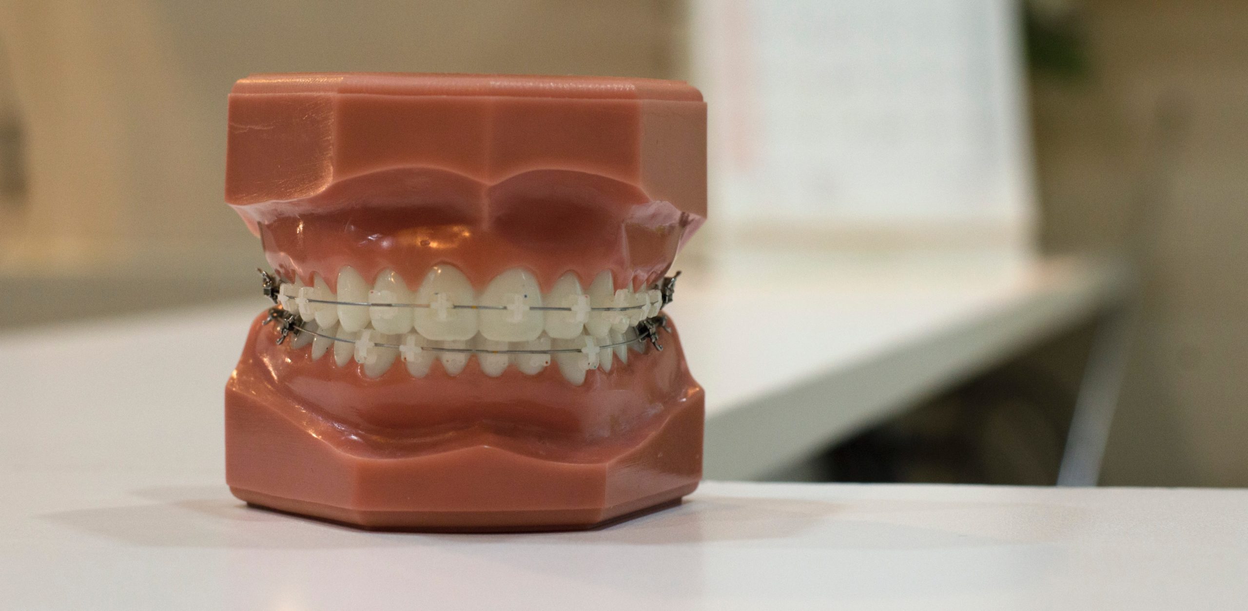 Orthodontic Braces in Las Vegas · Hansen Ortho