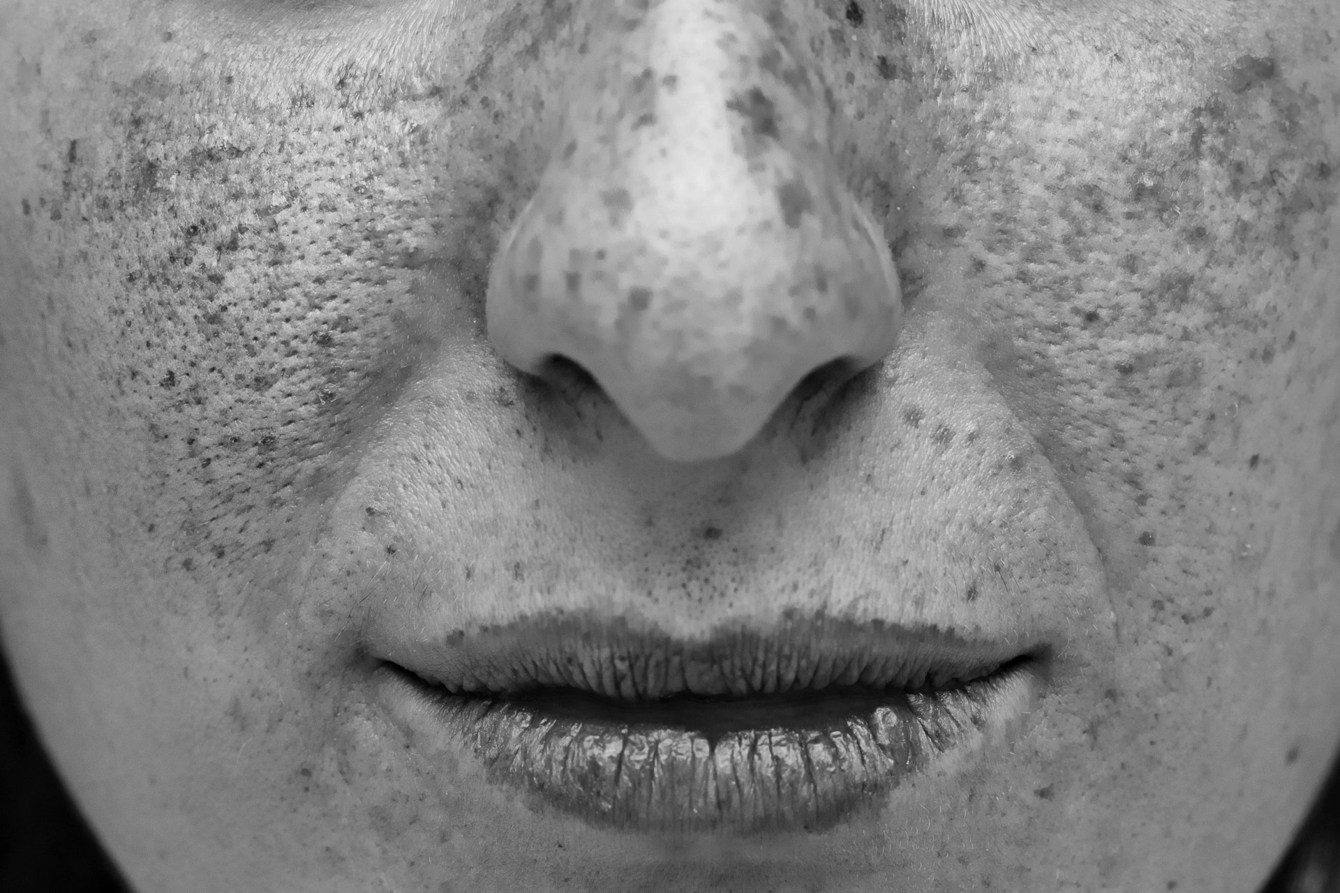 Can You Reverse SunDamaged Skin? Hansplace