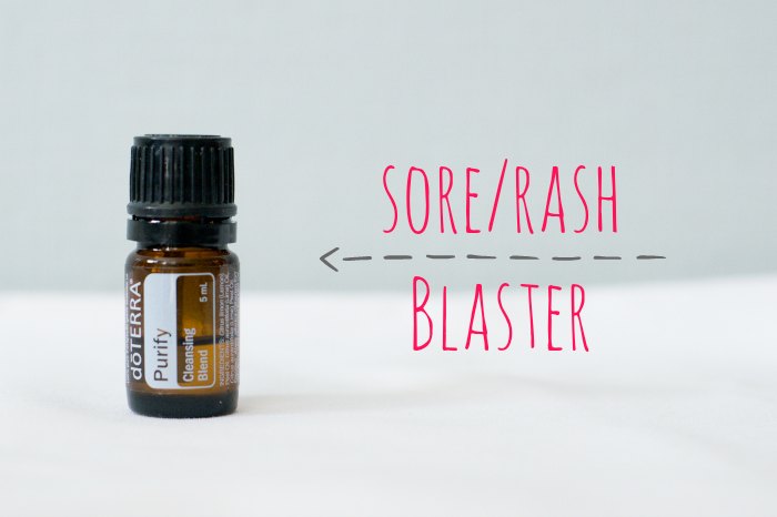 3 easy home remedies for Hand Foot and Mouth Disease