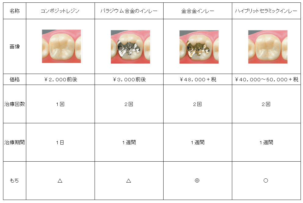 知らないと損する！虫歯の治療種類～治療費と治療期間～