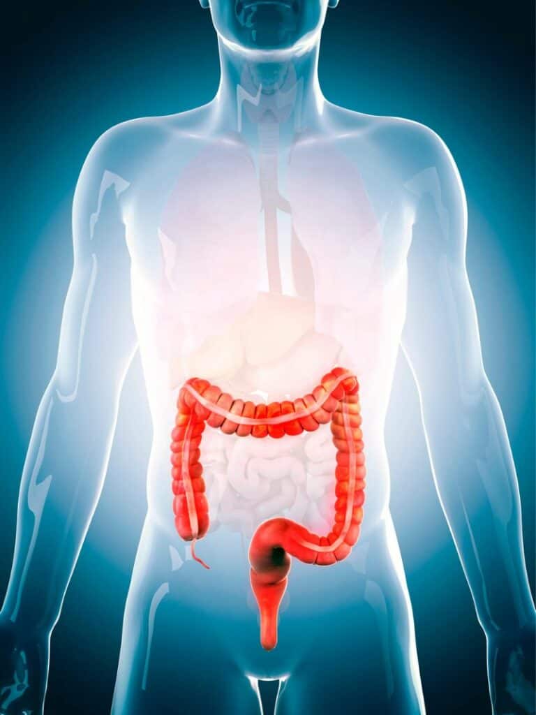 Exploring the Connection Between Spicy Food and Colon Cleansing