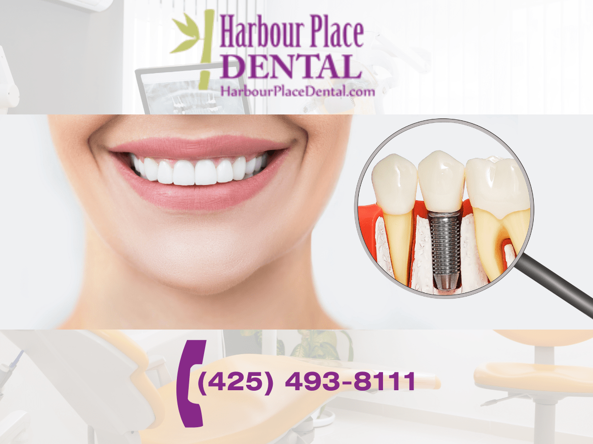 Mini Dental Implants A Compact Solution for Denture Stability and