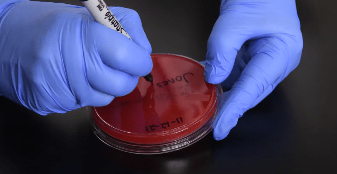 Learn How to Properly Streak a Petri Plate in 2023