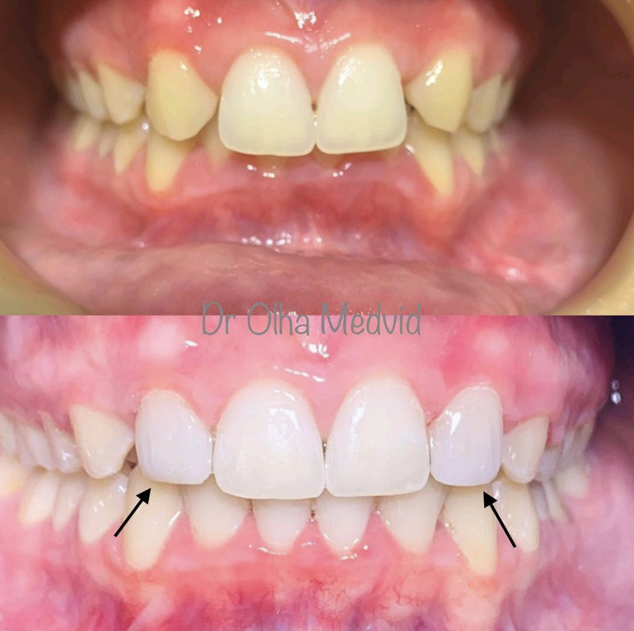 Before & After Transformations Harewood Dental Practice in Virginia