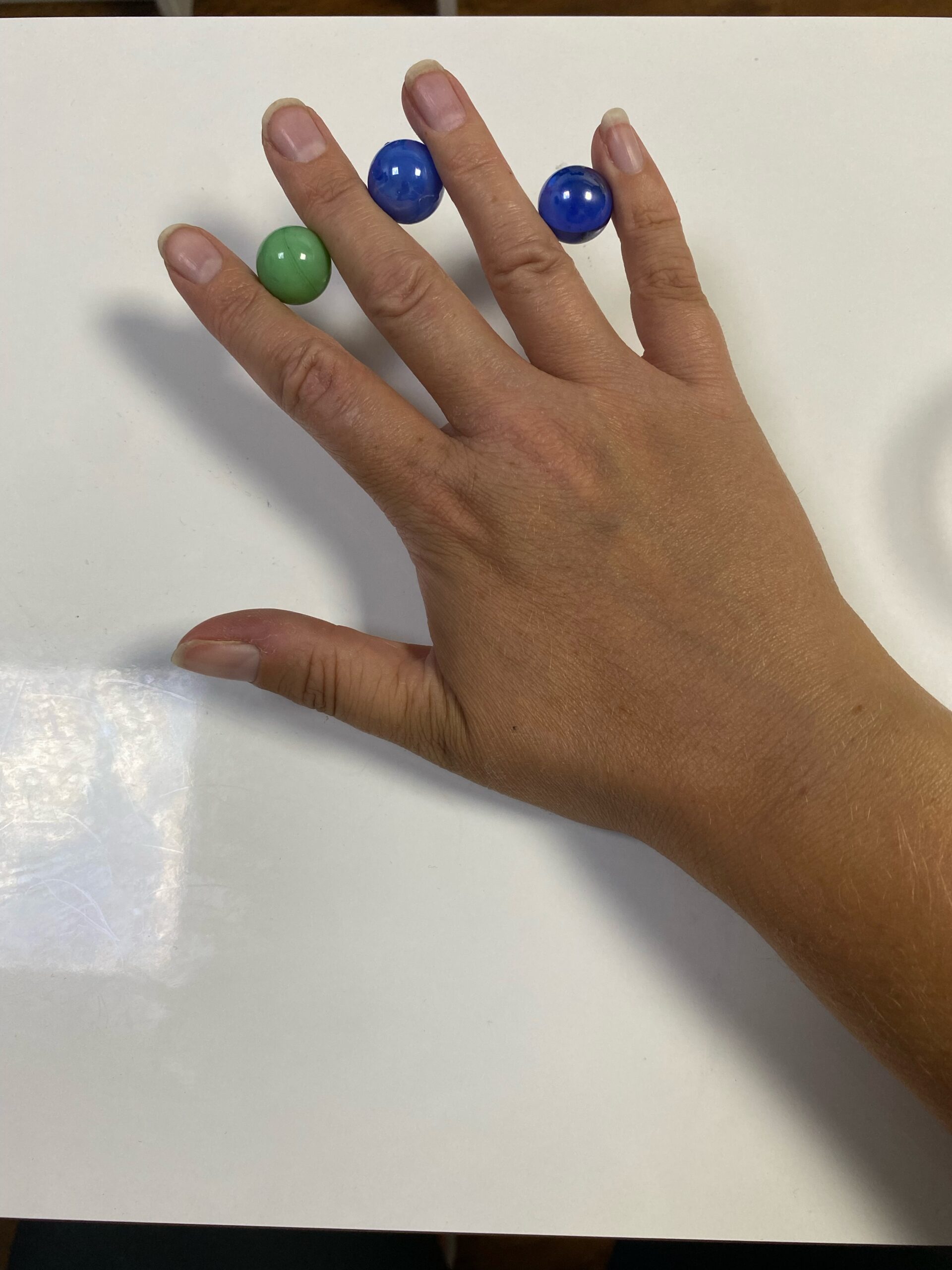 Hand Therapy Harley Clinic